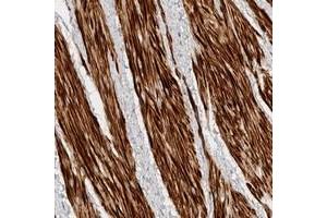 Immunohistochemical staining of human smooth muscle with TTI2 polyclonal antibody  shows strong cytoplasmic positivity at 1:20-1:50 dilution.