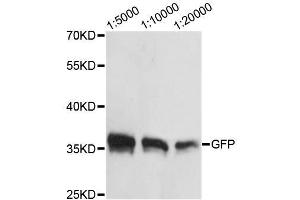 Western blot analysis of over-expressed GFP fusion protein in 293 cell using GFP-Tag antibody.