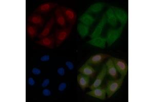 Phospho-FOXO1A (Ser329) Mouse Monoclonal Antibody staining Hela cells by IF/ICC. (FOXO1 Antikörper  (pSer329))