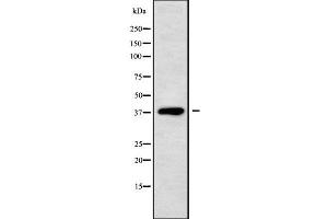Western blot analysis of DHRS7 using Jurkat whole cell lysates (DHRS7 Antikörper  (C-Term))