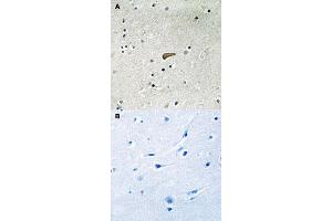 Immunohistochemical staining of human brain tissue by FRS2 (phospho Y436) polyclonal antibody  without blocking peptide (A) or preincubated with blocking peptide (B) under 1:50-1:100 dilution. (FRS2 Antikörper  (pTyr436))