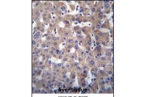 GGT2 Antibody (N-term) (ABIN656774 and ABIN2845993) immunohistochemistry analysis in formalin fixed and paraffin embedded human liver tissue followed by peroxidase conjugation of the secondary antibody and DAB staining.