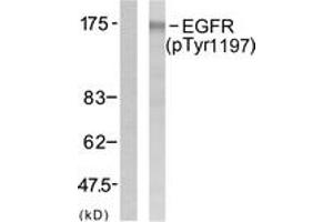 Western blot analysis of extracts from A431 cells treated with EGF 40 muM 10', using EGFR (Phospho-Tyr1197) Antibody. (EGFR Antikörper  (pTyr1197))