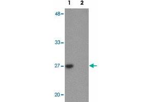 Western blot analysis of TMEM59 in human kidney tissue lysate with TMEM59 polyclonal antibody  at 1 ug/mL in (1) the absence and (2) the presence of blocking peptide. (TMEM59 Antikörper  (N-Term))