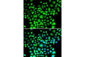 Immunofluorescence analysis of U2OS cells using BCAP31 antibody. (BCAP31 Antikörper  (AA 127-246))