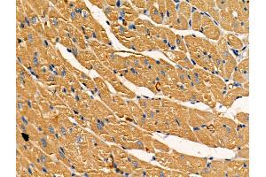 ABIN7093234 and ABIN7097246 at 1/100 staining Rat heart tissue by IHC-P. (SOD2 Antikörper  (acLys68))