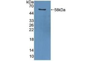 Detection of Recombinant PCNA using Polyclonal Antibody to Proliferating Cell Nuclear Antigen (PCNA) (PCNA Antikörper  (AA 6-261))