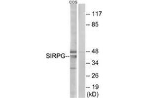 Western blot analysis of extracts from COS cells, using SIRPG Antibody. (SIRPG Antikörper  (AA 101-150))