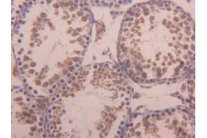 Immunohistochemistry (IHC) image for anti-Activin Receptor Type I (ACRV1) (AA 208-340) antibody (ABIN1174014)