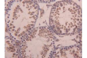DAB staining on IHC-P; Samples: Mouse Testis Tissue (ACVR1 Antikörper  (AA 208-340))
