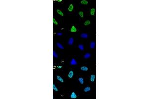 Histone H3 acetyl Lys27 mAb tested by immunofluorescence. (Histone 3 Antikörper  (H3K27ac))