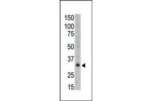Image no. 1 for anti-Melanoma Antigen Family A, 6 (MAGEA6) (C-Term) antibody (ABIN358649) (MAGEA6 Antikörper  (C-Term))