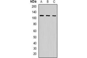 Western blot analysis of p115 expression in BT474 (A), K562 (B), A549 (C) whole cell lysates.