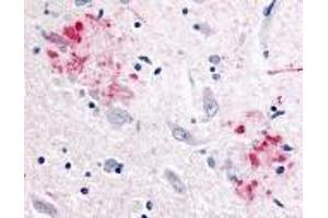 Immunohistochemistry of APP in human brain (Alzheimer’s disease) tissue with APP antibody at 10 μg/ml. (APP Antikörper)