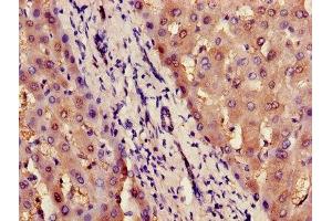 Immunohistochemistry of paraffin-embedded human liver tissue using ABIN7156716 at dilution of 1:100 (ILF2 Antikörper  (AA 1-390))