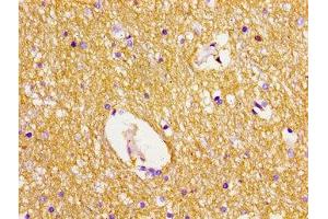 Immunohistochemistry of paraffin-embedded human brain tissue using ABIN7150072 at dilution of 1:100 (DLG2 Antikörper  (AA 310-420))