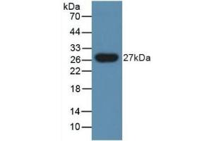 Detection of PGLYRP1 in Human Urine using Polyclonal Antibody to Peptidoglycan Recognition Protein 1 (PGLYRP1) (PGLYRP1 Antikörper  (AA 18-183))