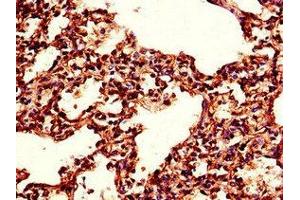 Immunohistochemistry of paraffin-embedded human lung tissue using ABIN7173415 at dilution of 1:100 (TPI1 Antikörper  (AA 169-228))