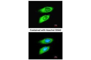 ICC/IF Image Immunofluorescence analysis of methanol-fixed HeLa, using MIF, antibody at 1:200 dilution. (MIF Antikörper)