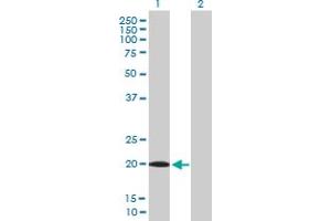 Western Blot analysis of UXT expression in transfected 293T cell line by UXT MaxPab polyclonal antibody. (UXT Antikörper  (AA 1-169))