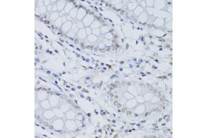 Immunohistochemistry of paraffin-embedded human colon using SNRNP70 antibody (ABIN5973598) at dilution of 1/100 (40x lens).