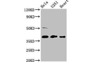 Western Blot Positive WB detected in: Hela whole cell lysate, U251 whole cell lysate, Mouse heart tissue All lanes: RCN3 antibody at 4. (RCN3 Antikörper  (AA 71-161))
