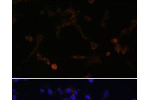 Immunofluorescence analysis of NIH/3T3 cells using UBE2L6 Polyclonal Antibody at dilution of 1:100. (UBE2L6 Antikörper)