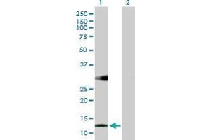 Lane 1: RBP5 transfected lysate ( 15.