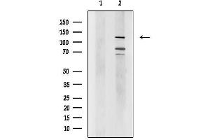 Western blot analysis of lysates from HepG2 cells, using FOG2 Antibody.