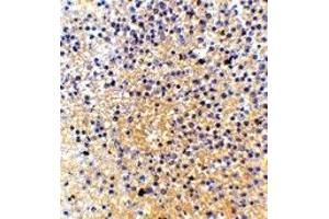 Immunohistochemistry (IHC) image for anti-Lymphocyte Antigen 86 (LY86) (Middle Region) antibody (ABIN1030998) (LY86 Antikörper  (Middle Region))