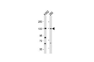 All lanes : Anti-BARON Antibody (N-term) at 1:2000 dilution Lane 1: K562 whole cell lysate Lane 2: 293 whole cell lysate Lysates/proteins at 20 μg per lane.