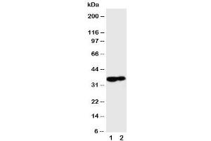 Western blot testing of Kallikrein 9 antibody and Lane 1:  MCF-7