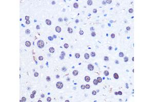 Immunohistochemistry of paraffin-embedded Mouse liver using CHD4 Polyclonal Antibody at dilution of 1:100 (40x lens). (CHD4 Antikörper)