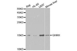 Western blot analysis of extracts of various cell lines, using GHRH antibody. (GHRH Antikörper  (AA 21-107))