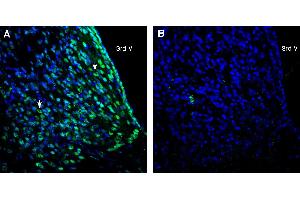 Expression of CD81 in rat medial habenula. (CD81 Antikörper  (Extracellular))