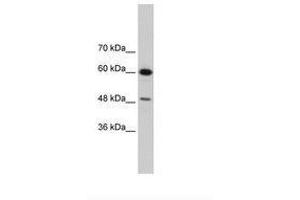 Image no. 3 for anti-DAZ Associated Protein 1 (DAZAP1) (AA 321-370) antibody (ABIN202449) (DAZAP1 Antikörper  (AA 321-370))