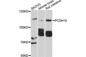 Western blot analysis of extracts of various cell lines, using PCDH10 antibody (ABIN4904694) at 1:1000 dilution. (PCDH10 Antikörper)