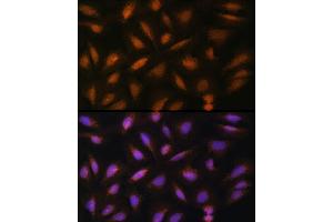 Immunofluorescence analysis of U-2 OS cells using FGF2 Rabbit pAb (ABIN3020744, ABIN3020745, ABIN3020746 and ABIN6213702) at dilution of 1:100 (40x lens). (FGF2 Antikörper  (AA 143-288))