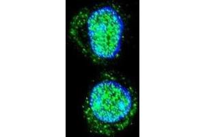 Immunofluorescence (IF) image for anti-Homeobox A10 (HOXA10) antibody (ABIN2995594) (HOXA10 Antikörper)