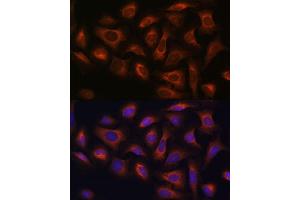 Immunofluorescence analysis of U-2 OS cells using  antibody (ABIN7265486) at dilution of 1:100. (arfgap2 Antikörper  (AA 242-521))