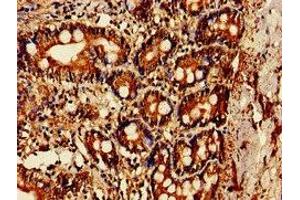 Immunohistochemistry of paraffin-embedded human small intestine tissue using ABIN7142170 at dilution of 1:100 (OAS1 Antikörper  (AA 296-395))