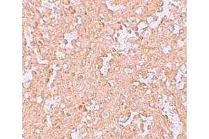 Immunohistochemical staining of human spleen cells with ZBTB8 polyclonal antibody  at 2. (ZBTB8A Antikörper  (C-Term))