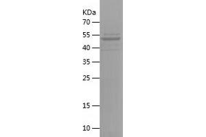 Western Blotting (WB) image for Ubiquitin Specific Peptidase 18 (USP18) (AA 18-268) protein (His-IF2DI Tag) (ABIN7125590) (USP18 Protein (AA 18-268) (His-IF2DI Tag))