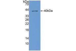 Western blot analysis of recombinant Human NAP3. (CXCL1 Antikörper  (AA 35-107))