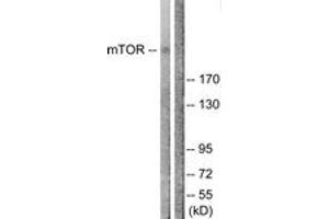 Western blot analysis of extracts from NIH-3T3 cells, treated with Insulin 0. (MTOR Antikörper  (AA 2412-2461))