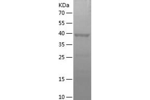MAT1A Protein (AA 215-395) (His-IF2DI Tag)