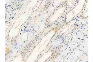 ABIN6259789 and ABIN6279091 at 1/100 staining human normal kidney tissue by IHC-P.