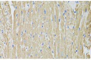 Immunohistochemistry of paraffin-embedded Rat heart using FHIT Polyclonal Antibody at dilution of 1:100 (40x lens). (FHIT Antikörper)