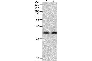 Western blot analysis of k562 cell and Hela cell, using HAVCR1 Polyclonal Antibody at dilution of 1:700 (HAVCR1 Antikörper)