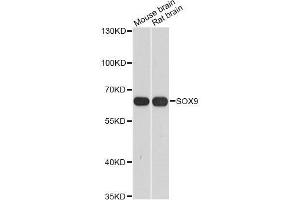 Western blot analysis of extracts of various cell lines, using SOX9 antibody. (SOX9 Antikörper  (AA 100-200))